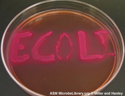 escherichia-coli-fig5