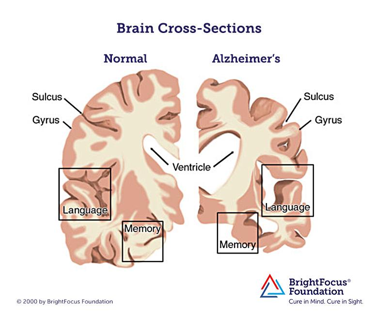 Brain_Cross-Sections