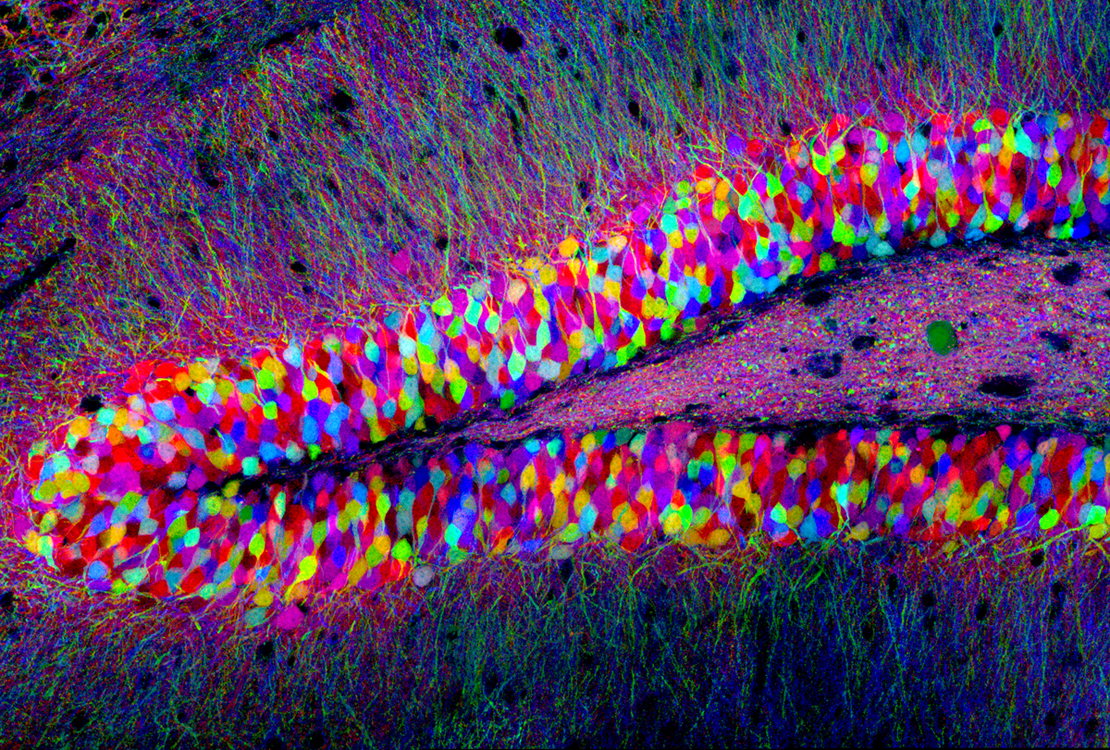WiTdaily 004 – ตกลงสมองเราสร้างเซลใหม่ได้หรือไม่? คุยงานวิจัยใหม่ล่าสุดกับน้อ�